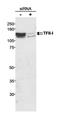 General Transcription Factor IIi antibody, NB500-156, Novus Biologicals, Western Blot image 