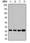 Protein Phosphatase, Mg2+/Mn2+ Dependent 1A antibody, orb341153, Biorbyt, Western Blot image 