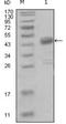 Discoidin Domain Receptor Tyrosine Kinase 1 antibody, NBP1-28861, Novus Biologicals, Western Blot image 
