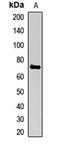 Hematopoietic Cell-Specific Lyn Substrate 1 antibody, LS-C667833, Lifespan Biosciences, Western Blot image 