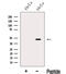 Ceramide Synthase 2 antibody, GTX02887, GeneTex, Western Blot image 