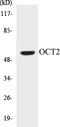 POU Class 2 Homeobox 2 antibody, EKC1004, Boster Biological Technology, Western Blot image 