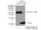 NADH:Ubiquinone Oxidoreductase Subunit B7 antibody, 14912-1-AP, Proteintech Group, Immunoprecipitation image 