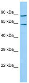 Tigger Transposable Element Derived 7 antibody, TA331683, Origene, Western Blot image 