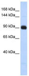 Matrilin 2 antibody, TA344662, Origene, Western Blot image 