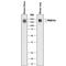 Platelet Derived Growth Factor Receptor Alpha antibody, AF1062, R&D Systems, Western Blot image 