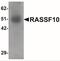 Ras association domain-containing protein 10 antibody, NBP2-41130, Novus Biologicals, Western Blot image 
