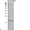 Transforming Growth Factor Alpha antibody, LS-C814190, Lifespan Biosciences, Western Blot image 