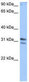TRNA Methyltransferase 10B antibody, TA343997, Origene, Western Blot image 