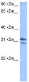 TRNA Methyltransferase 10B antibody, TA343997, Origene, Western Blot image 