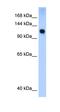 SWI/SNF Related, Matrix Associated, Actin Dependent Regulator Of Chromatin, Subfamily A, Member 5 antibody, orb329561, Biorbyt, Western Blot image 