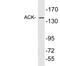 ACK1 antibody, LS-C199759, Lifespan Biosciences, Western Blot image 