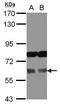 Aladin WD Repeat Nucleoporin antibody, PA5-27197, Invitrogen Antibodies, Western Blot image 