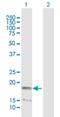 Nucleoside diphosphate kinase, mitochondrial antibody, H00004833-B01P, Novus Biologicals, Western Blot image 