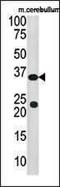 Sulfotransferase Family 4A Member 1 antibody, PA5-12253, Invitrogen Antibodies, Western Blot image 