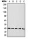 ATPase Na+/K+ Transporting Subunit Beta 3 antibody, orb216027, Biorbyt, Western Blot image 