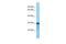 Arginine And Glutamate Rich 1 antibody, PA5-70279, Invitrogen Antibodies, Western Blot image 