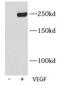 Kinase Insert Domain Receptor antibody, FNab09964, FineTest, Western Blot image 