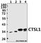 Cathepsin L antibody, GTX66824, GeneTex, Western Blot image 
