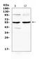 Matrix Metallopeptidase 10 antibody, A03759-1, Boster Biological Technology, Western Blot image 