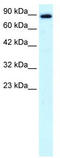 Kinesin Family Member 21A antibody, TA334700, Origene, Western Blot image 