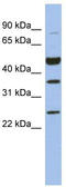 MAGE Family Member B3 antibody, TA337658, Origene, Western Blot image 