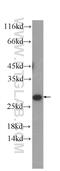 Secreted And Transmembrane 1 antibody, 60281-1-Ig, Proteintech Group, Western Blot image 