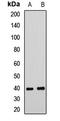 RISC-loading complex subunit TARBP2 antibody, LS-C668217, Lifespan Biosciences, Western Blot image 