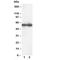 DNA Nucleotidylexotransferase antibody, R30329, NSJ Bioreagents, Western Blot image 