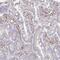Slingshot Protein Phosphatase 2 antibody, PA5-63402, Invitrogen Antibodies, Immunohistochemistry frozen image 