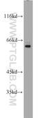 SP110 Nuclear Body Protein antibody, 11502-1-AP, Proteintech Group, Western Blot image 