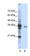 Exosome Component 3 antibody, orb324839, Biorbyt, Western Blot image 