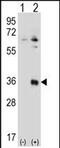 Testis Specific Serine Kinase 6 antibody, PA5-71708, Invitrogen Antibodies, Western Blot image 