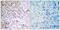 RB Transcriptional Corepressor 1 antibody, PA5-37715, Invitrogen Antibodies, Immunohistochemistry paraffin image 