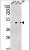 Actin Related Protein 3B antibody, LS-C156013, Lifespan Biosciences, Western Blot image 
