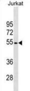 Arylsulfatase A antibody, abx025463, Abbexa, Western Blot image 