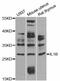 Interleukin 1 Beta antibody, abx125995, Abbexa, Western Blot image 