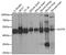 Acyl-CoA Thioesterase 9 antibody, A14147, Boster Biological Technology, Western Blot image 