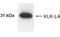 Kallikrein Related Peptidase 13 antibody, NB200-139, Novus Biologicals, Western Blot image 