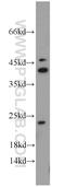Anti-Silencing Function 1A Histone Chaperone antibody, 10784-1-AP, Proteintech Group, Western Blot image 
