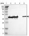 DnaJ Heat Shock Protein Family (Hsp40) Member B12 antibody, PA5-52720, Invitrogen Antibodies, Western Blot image 