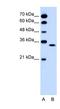 Olfactory Receptor Family 5 Subfamily T Member 2 antibody, NBP1-59622, Novus Biologicals, Western Blot image 