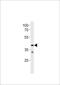 Trace Amine Associated Receptor 2 (Gene/Pseudogene) antibody, TA325158, Origene, Western Blot image 