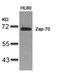 Zeta Chain Of T Cell Receptor Associated Protein Kinase 70 antibody, A00754, Boster Biological Technology, Western Blot image 