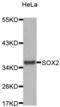 Quiescin Sulfhydryl Oxidase 1 antibody, abx004718, Abbexa, Western Blot image 