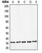 Galectin 3 antibody, LS-C352467, Lifespan Biosciences, Western Blot image 