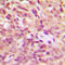 Heat Shock Protein Family B (Small) Member 1 antibody, GTX32195, GeneTex, Immunohistochemistry paraffin image 