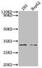 NADH:Ubiquinone Oxidoreductase Core Subunit S3 antibody, CSB-RA224121A0HU, Cusabio, Western Blot image 