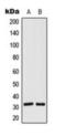 E3 ubiquitin-protein ligase SIAH1 antibody, orb224178, Biorbyt, Western Blot image 