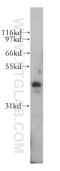 PBX Homeobox 3 antibody, 12571-1-AP, Proteintech Group, Western Blot image 